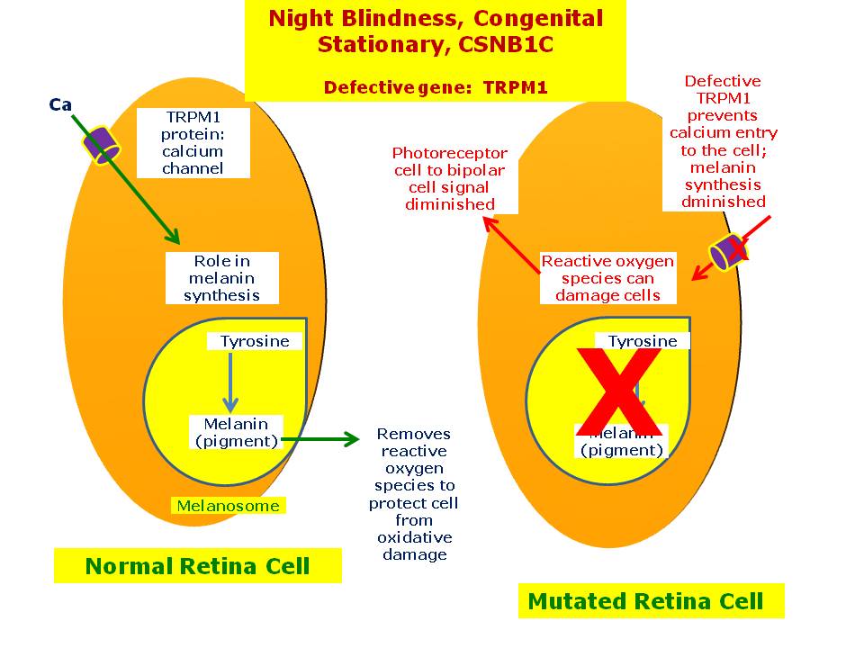 Night Blindness, Congenital Stationary, CSNB1C Hereditary Ocular Diseases